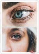 黑眼圈产生的原因有哪些？治疗黑眼圈最有效的方法