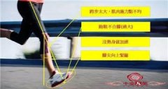 胫骨前肌是个什么鬼？你对它了解多少？