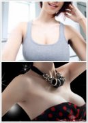 自体脂肪丰胸的优点是什么