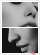鼻尖鼻翼缩小方法以及过程
