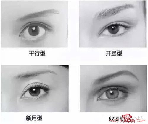 做定位双眼皮效果好