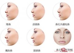 做3d仿生隆鼻后多久有效果